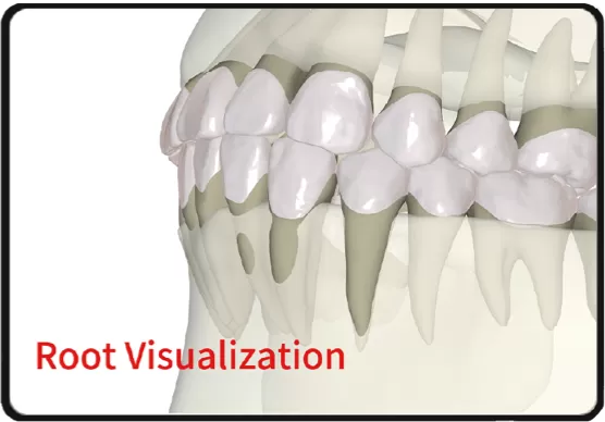 Root Visualization