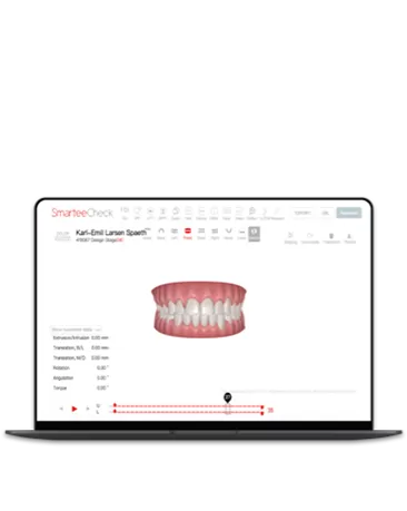 Virtual Treatment Simulation