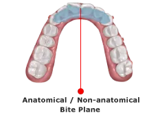 Mandibular Repositioning Device with Bite Plane