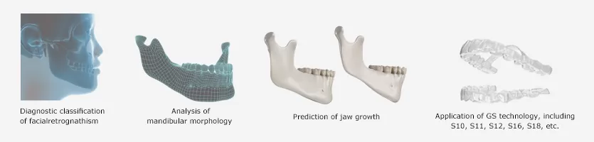 Early Correction of Facial Retrognathism Phased Treatment for the Whole Duration Comprehensive Treatment Plan