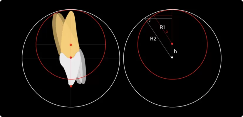 Make Accurate Tooth Movement Possible