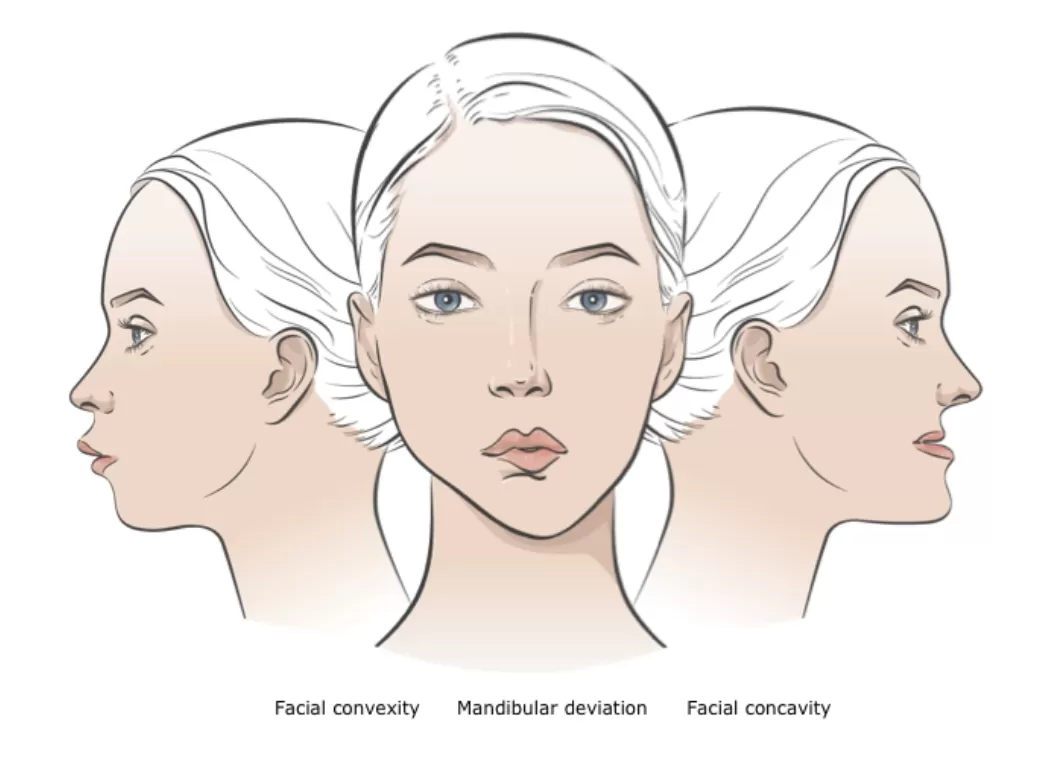 Mandibular Repositioning Technology