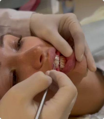 Mandibular repositioning simulation: