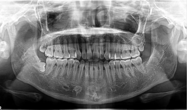 X-rays before treatment