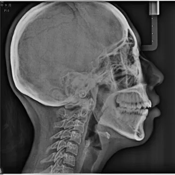 X-rays before treatment