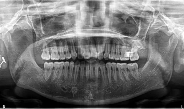 X-rays before treatment