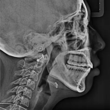 X-rays before treatment