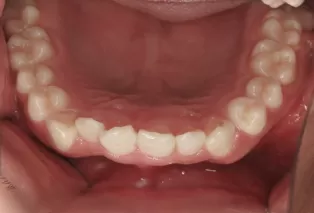 Intraoral photos