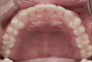 Intraoral photos