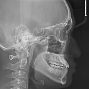 X-rays before treatment