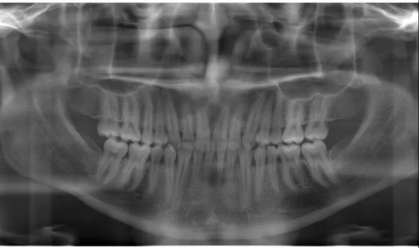 X-rays before treatment