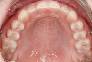 Intraoral photos