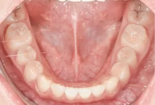 Intraoral photos