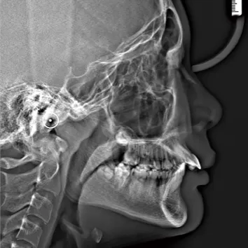 X-rays before treatment