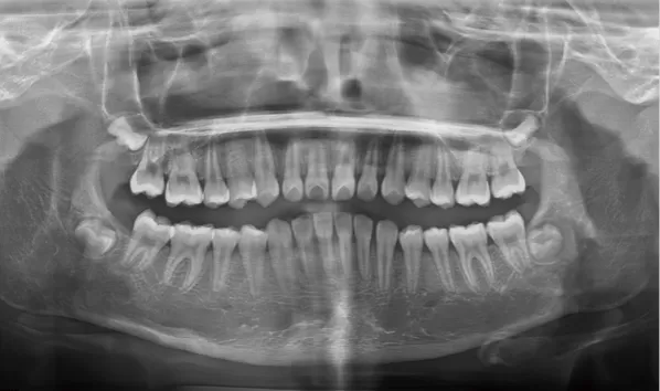 X-rays before treatment