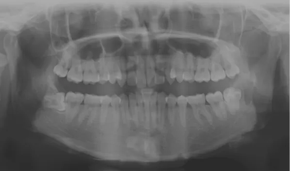 X-rays before treatment