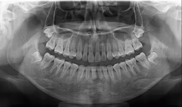 X-rays before treatment