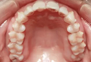 Intraoral photos