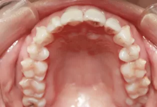 Intraoral photos