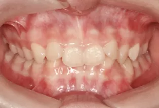 Intraoral photos