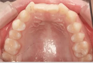 Intraoral photos