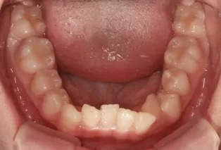 Intraoral photos