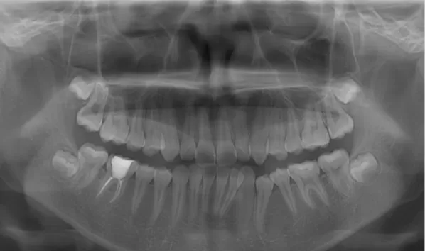 X-rays before treatment