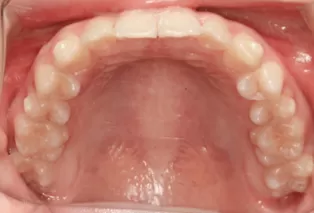 Intraoral photos