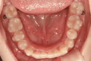 Intraoral photos