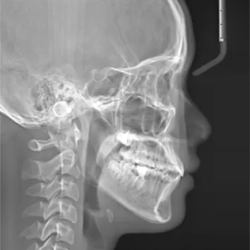 X-rays before treatment