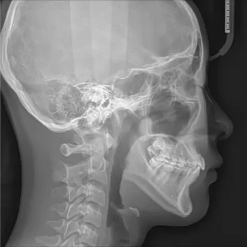 X-rays before treatment