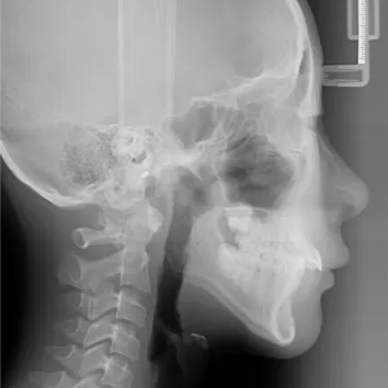 X-rays before treatment