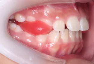 Intraoral photos