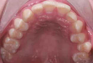 Intraoral photos