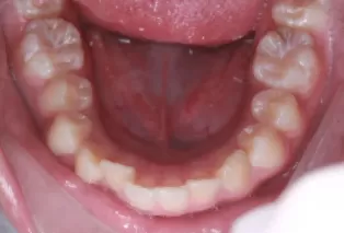 Intraoral photos