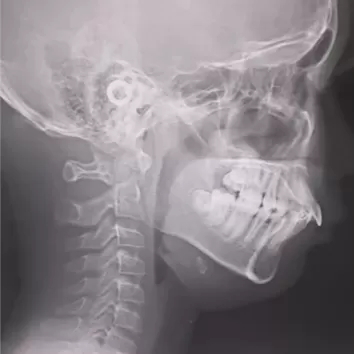 X-rays before treatment