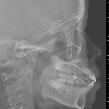 X-rays before treatment