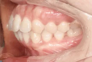 Intraoral photos