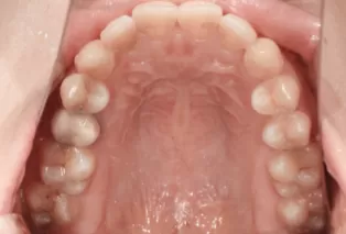 Intraoral photos