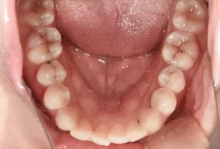 Intraoral photos