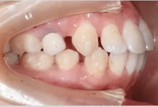 Intraoral photos