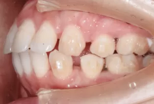 Intraoral photos