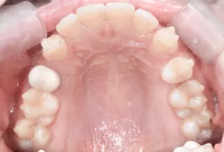 Intraoral photos