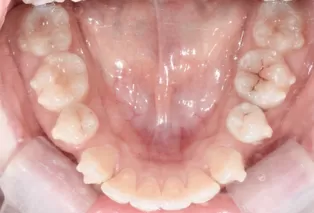 Intraoral photos