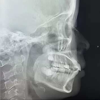 X-rays before treatment