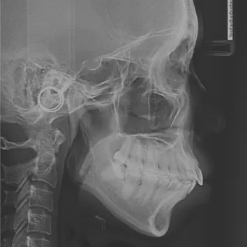 X-rays before treatment