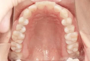 Intraoral photos