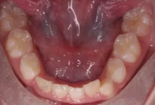 Intraoral photos