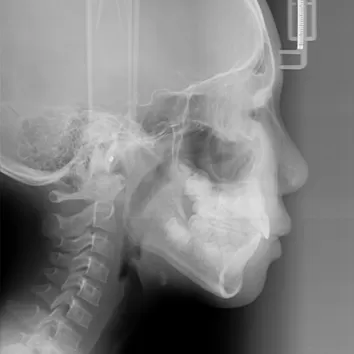 X-rays before treatment