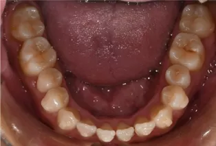 Intraoral photos